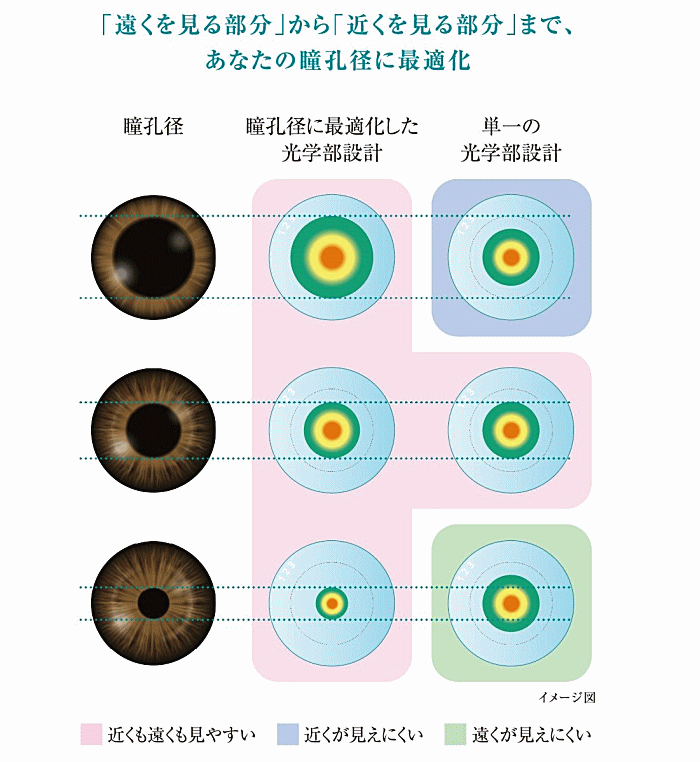 アキュビューオアシスマルチフォーカルの瞳孔径